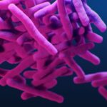 Tuberculosis outbreak declared public health eme...