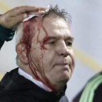 Mexico manager left bloodied after being struck by beer can