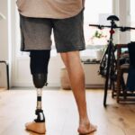 Health insurers limit coverage of prosthetic limbs, questioning their medical necessity