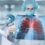 Groundbreaking real-time lung scans to revolutioni...