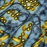 Louisiana person is the first US bird flu death, health officials say