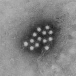 Boulder County health department warns of potential hepatitis A exposure at restaurant