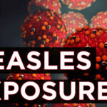 Possible measles exposure at 2 ER locations in Philadelphia region, health officials warn