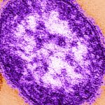 Philly health officials report second case of measles and exposures