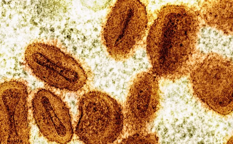 Health officials confirm mpox in Anchorage adult who traveled out of state